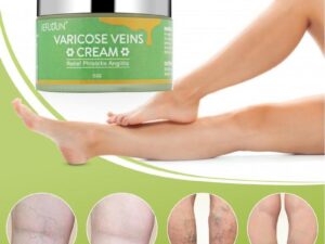 f8c032c3-df7d-4150-b123-71f139d8be1b Vein Cream Red Blood Streaks Repair Earthworm Leg Bruises Bulge Relief Pain Safflower Skin care lotion Varicose Cream